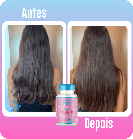 ANTESEDEPOIS (2)