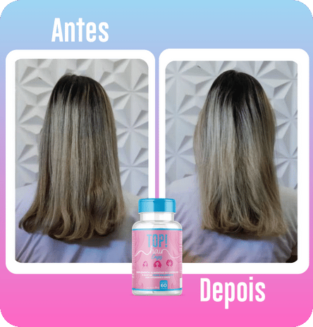 ANTESEDEPOIS (7)