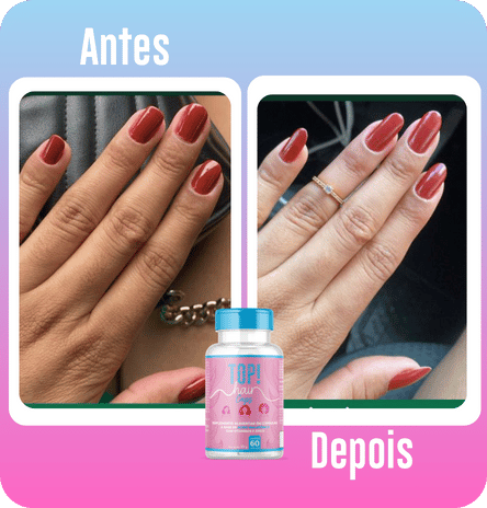 ANTESEDEPOIS (9)